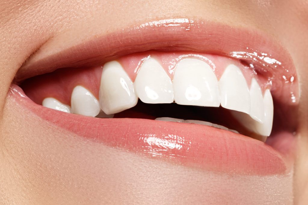 perfect smile