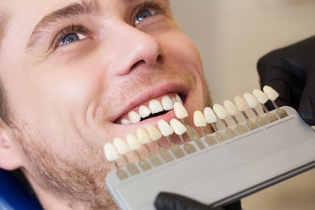Dental implants dentaires